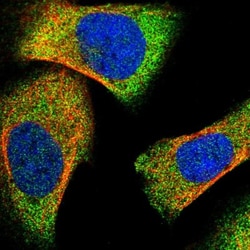Lipin 2 Antibody, Novus Biologicals:Antibodies:Primary Antibodies